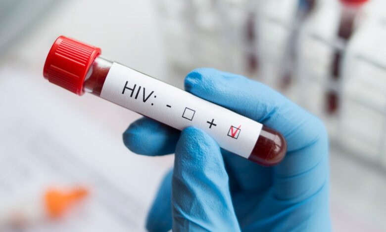 HIV transmission clause