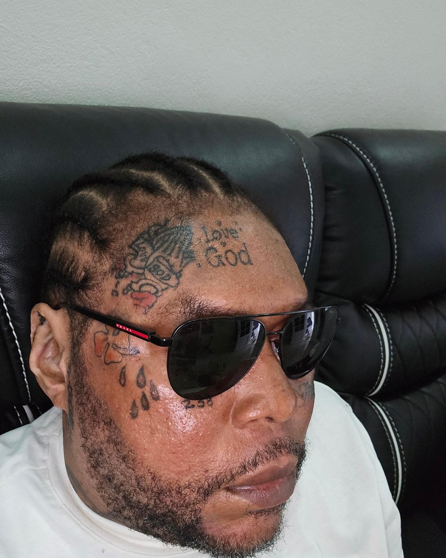 Vybz Kartel Shows His Face After Release And Discloses Graves Disease