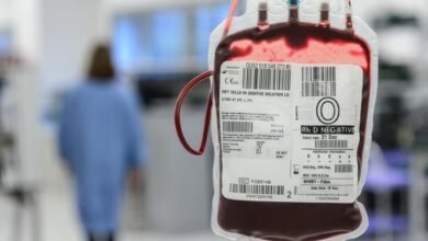 Blood Supply